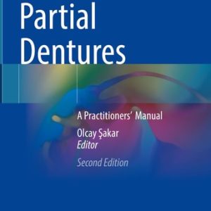 Removable Partial Dentures (A Practitioners’ Manual) (2nd Edition)
