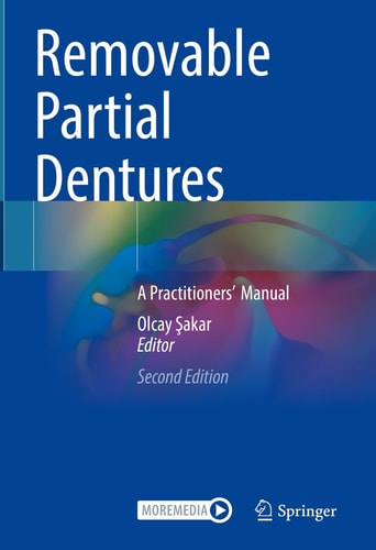 Removable Partial Dentures (A Practitioners’ Manual) (2nd Edition)