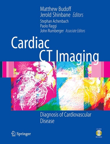 Cardiac CT Imaging (Diagnosis of Cardiovascular Disease)