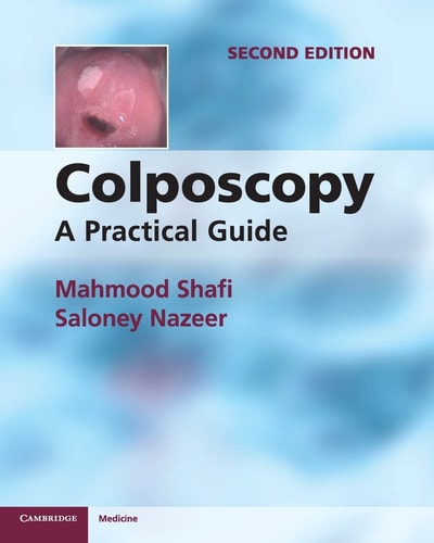 Colposcopy (A Practical Guide) (2nd Edition)